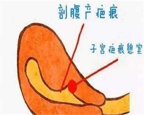 滁州供卵试管助孕包男孩公司添子供卵医院想在做试管助孕包男孩代生