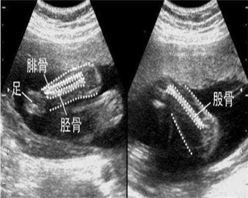 2026在山大生殖做供精试管婴儿实用指南，附助孕流程及手续介绍