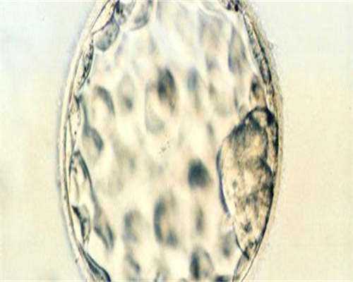 内蒙代孕服务,2026泰国第三代试管婴儿价格明细曝光(一文了解全部费用)