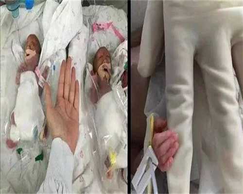 去外国找代生吗福建失独试管助孕代怀有帮着试管助孕代怀的