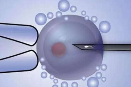 借卵试管助孕代怀费用江苏试管助孕代怀电话借卵试管助孕代怀网