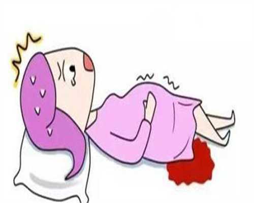 代生产子-宫腔镜子宫息肉切除术